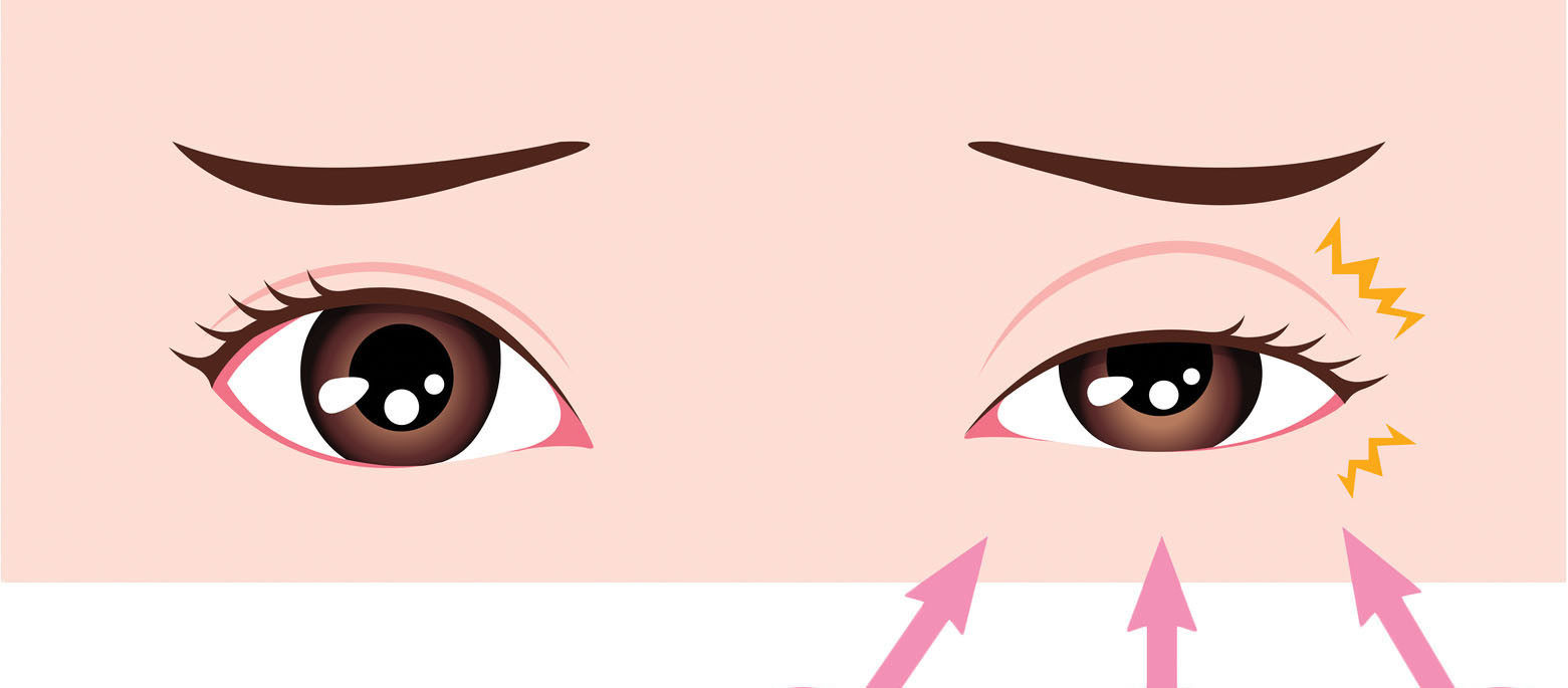 What Does Left Eye Twitching in Women Mean? Decoding the Phenomenon